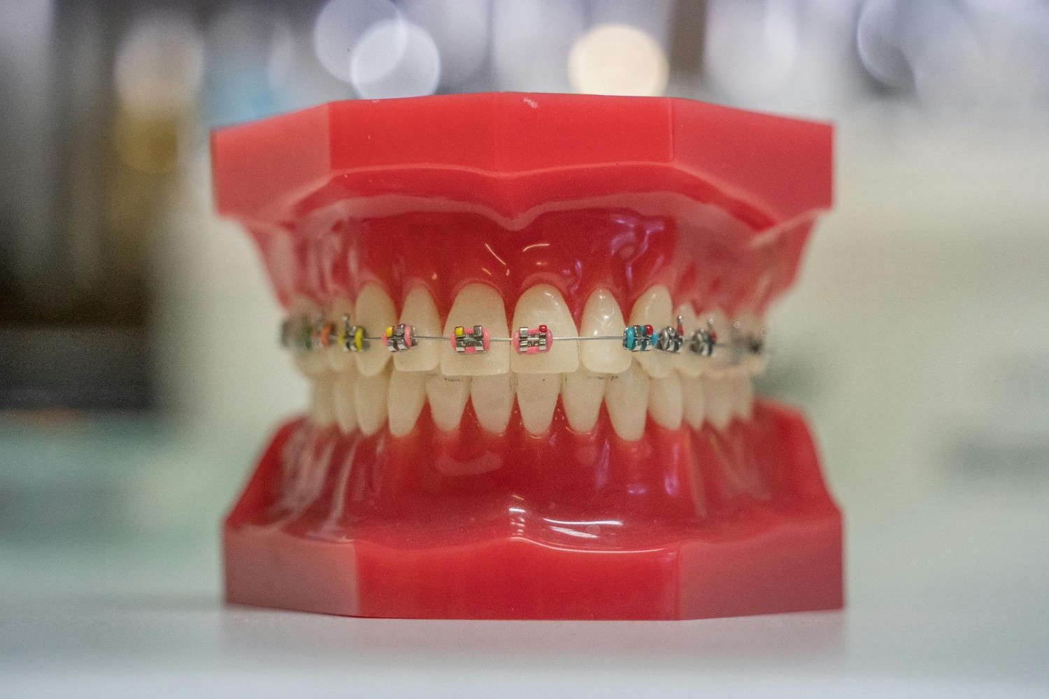 Smile Results